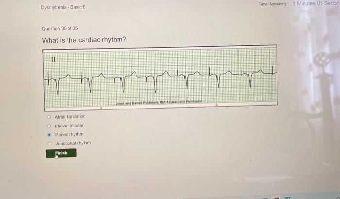 Flex ed dysrhythmia test answers