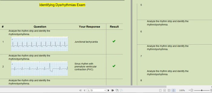 Flex ed dysrhythmia test answers