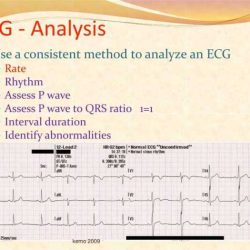 Flex ed dysrhythmia test answers