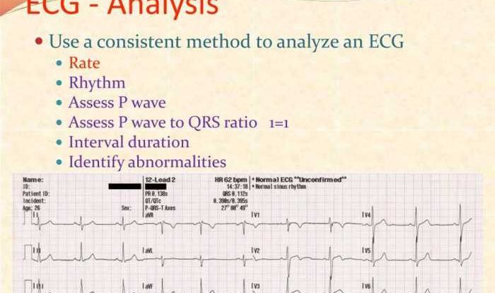 Flex ed dysrhythmia test answers