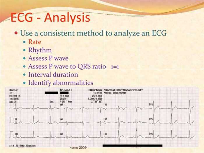 Flex ed dysrhythmia test answers